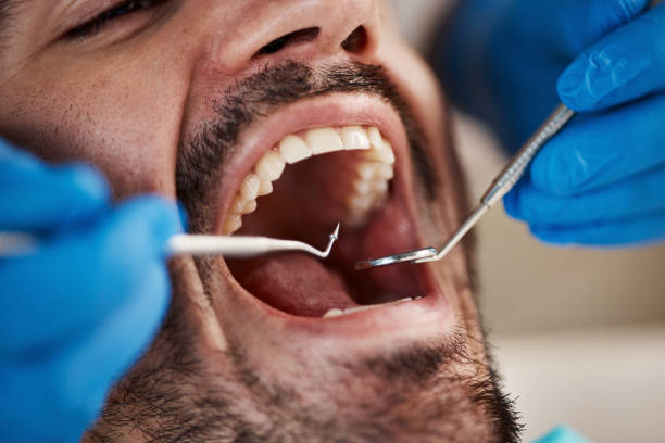 Best Weekend Emergency Dentist in Mount Sterling, OH