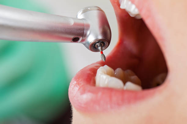 Best Emergency Denture Repair in Mount Sterling, OH